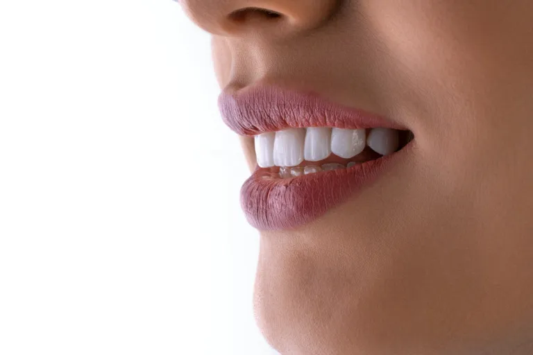 Composite bonding