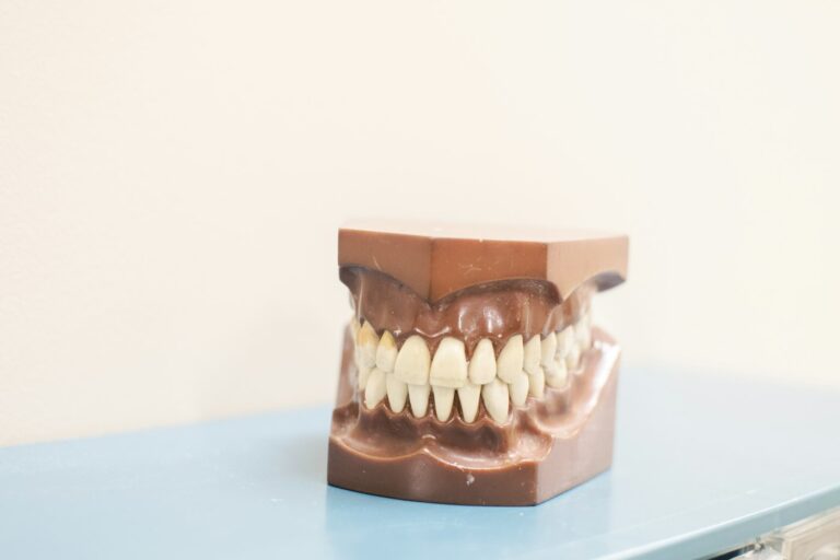 Ceramic bridge