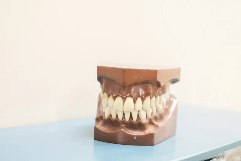 Ceramic bridge