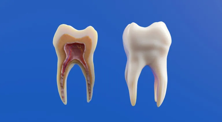 Re-root canal treatment