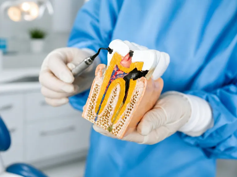 Single-visit root canal