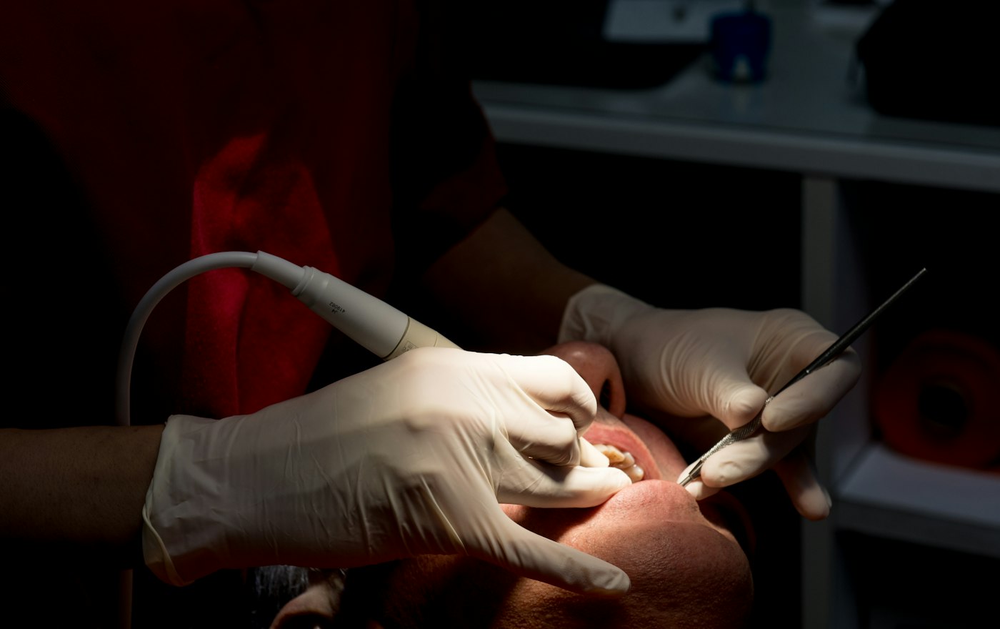 Teeth cleaning at the dentist